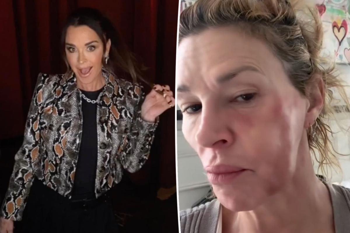Brandi Glanville Shouts Thanks to Kyle Richards as $22K Nears $28K Medical Goal