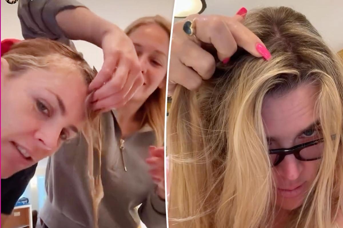 Busy Philipps Shows Raw Recovery After Life‑Saving Brain Tumor Surgery