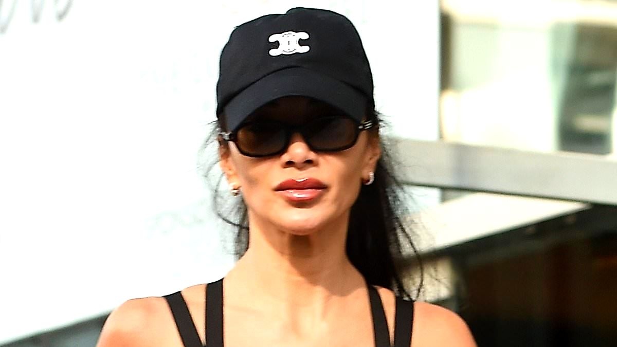 Nicole Scherzinger's 48‑Year‑Old Leg Burn Turns Fans into Heroes
