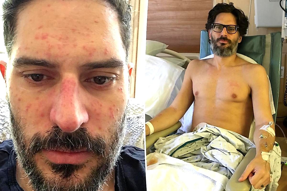 Joe Manganiello's 60‑Pound Weight Loss After Surgery Shocks Fans