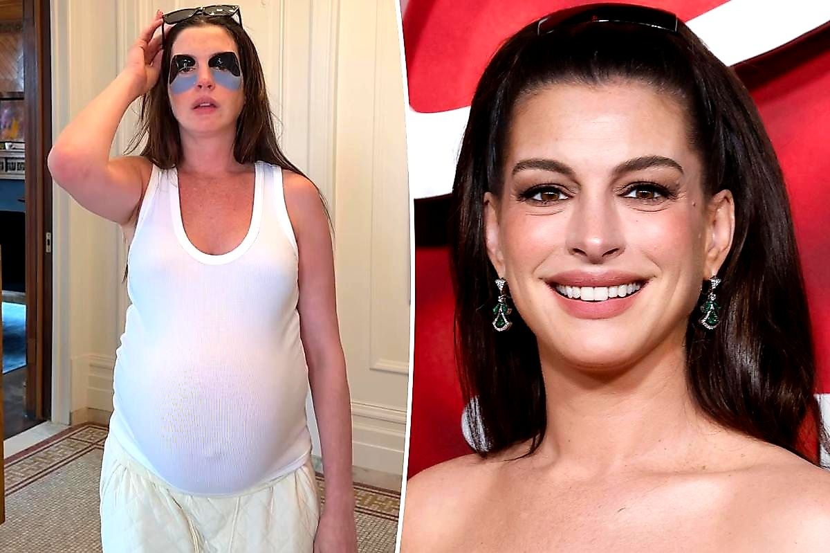 Anne Hathaway's 20% Off 111Skin Eye Masks During Prime Day Shock Fans