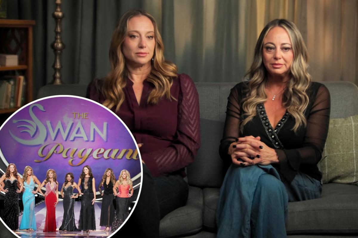 The Swan star survives a near‑death plastic‑surgery, as revealed in Hulu doc