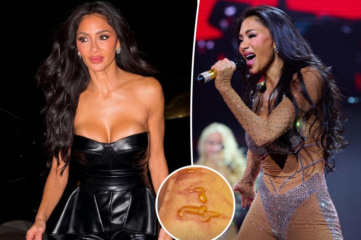 Nicole Scherzinger defies leg burn after water scare before concert