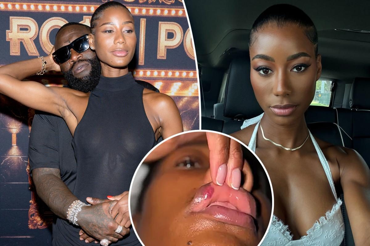 Rick Ross Ex Jazzma Kendrick Shows Bloody Lip After 'Punching Bag' Claim