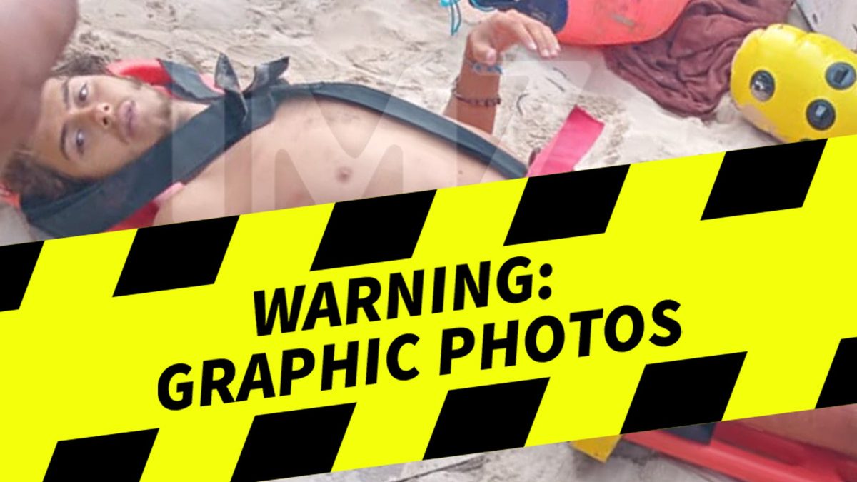 Propeller cuts leg, Stavros Floros sues Survivor Greece for $100M